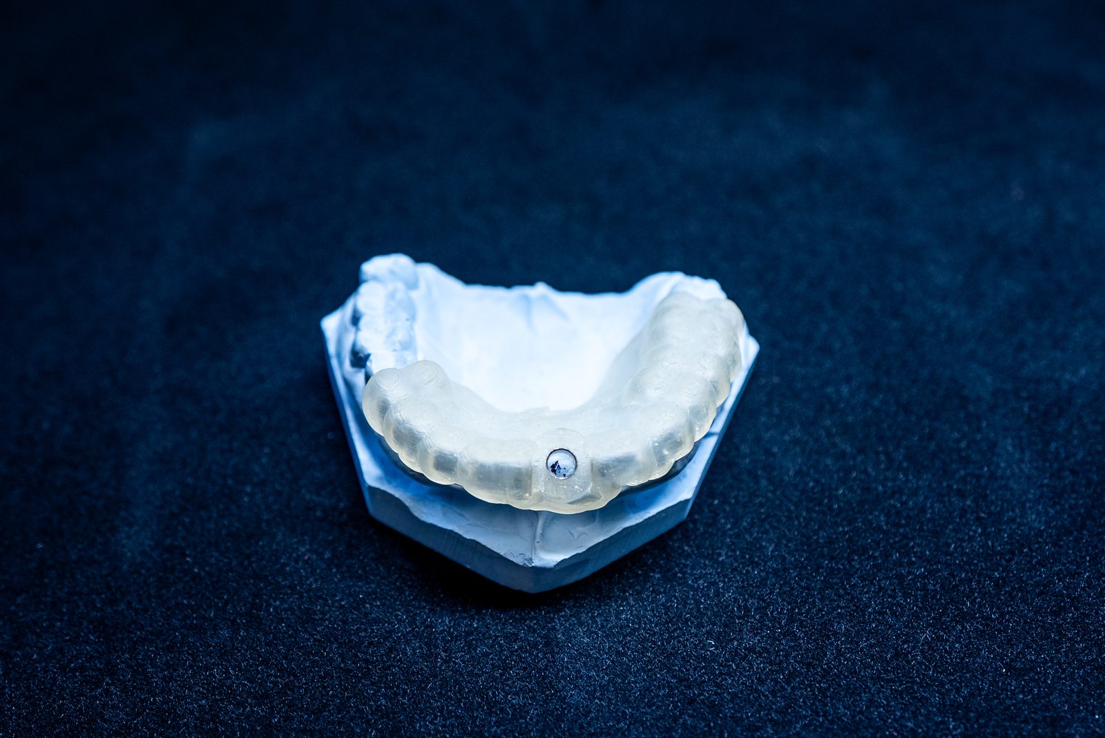 Traditional dental implant model showing robust titanium post for long-term stability in the jawbone